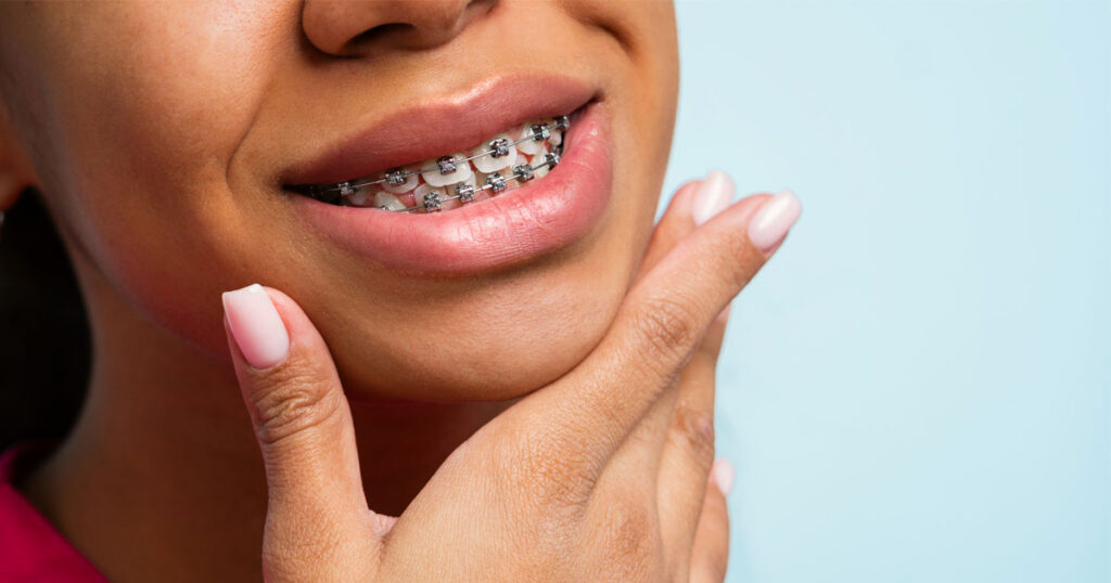 Learn How Braces Can Address An Overbite