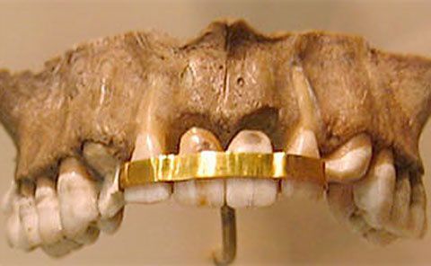 A Short History of Orthodontics