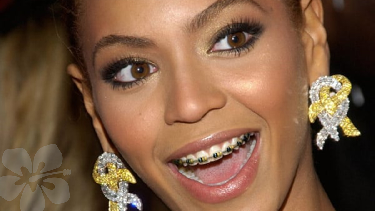 Celebrities With Braces